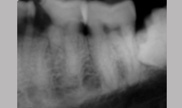 Dental care in Anand                        